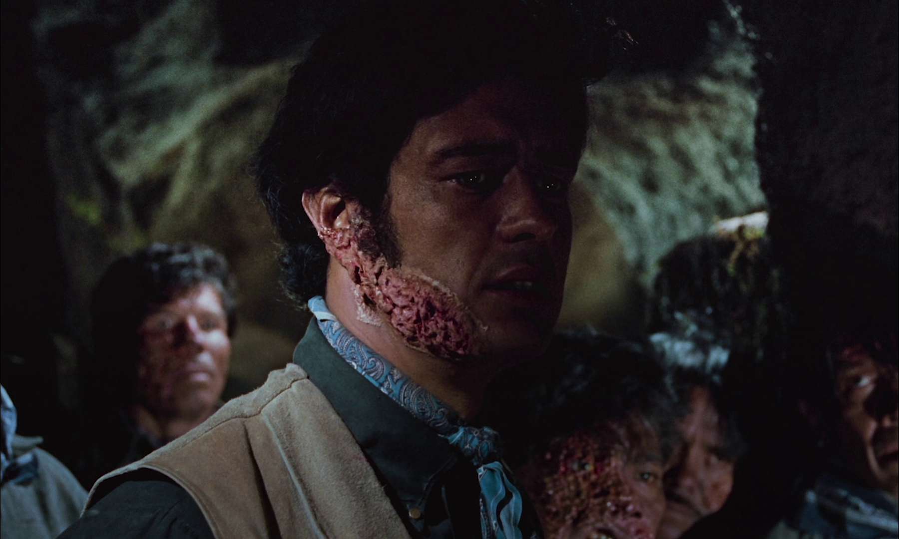 Leprosy In Film: Sure, they walk a lot like zombies and break into houses, but doctors and lawmen plead for compassion, mercy and understanding toward them.