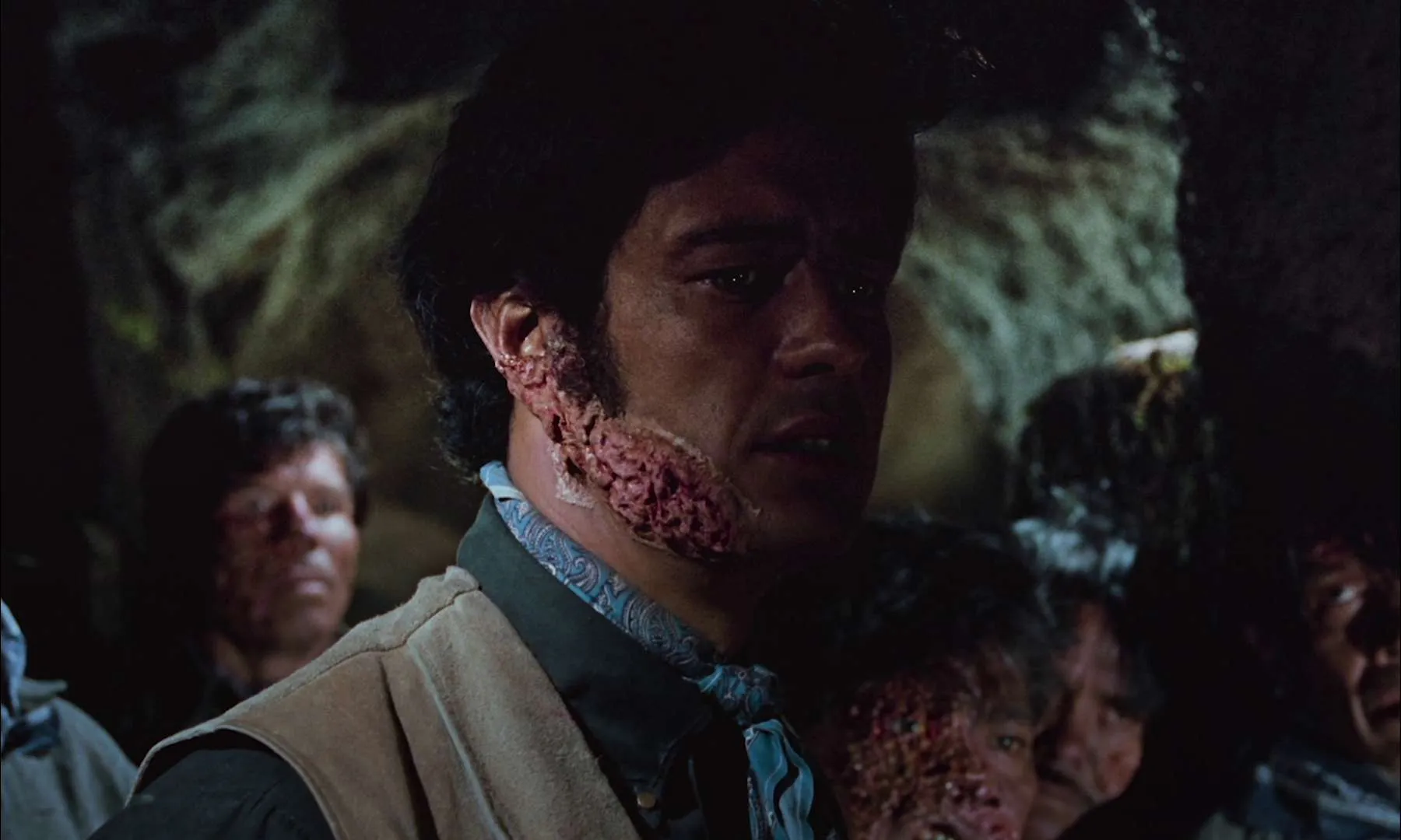 Leprosy In Film: Sure, they walk a lot like zombies and break into houses, but doctors and lawmen plead for compassion, mercy and understanding toward them.