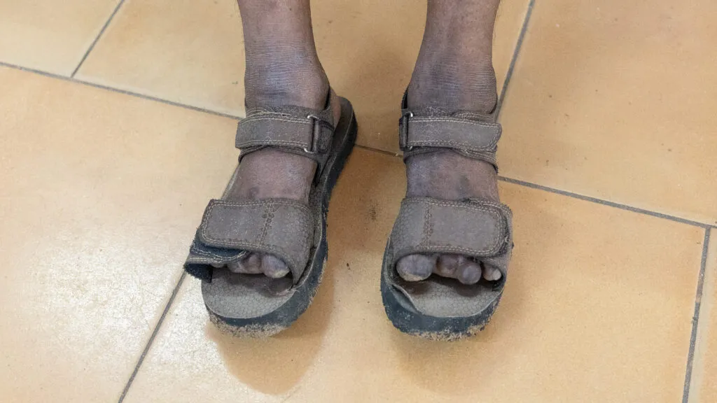 Protective sandals designed to prevent injury for numb feet