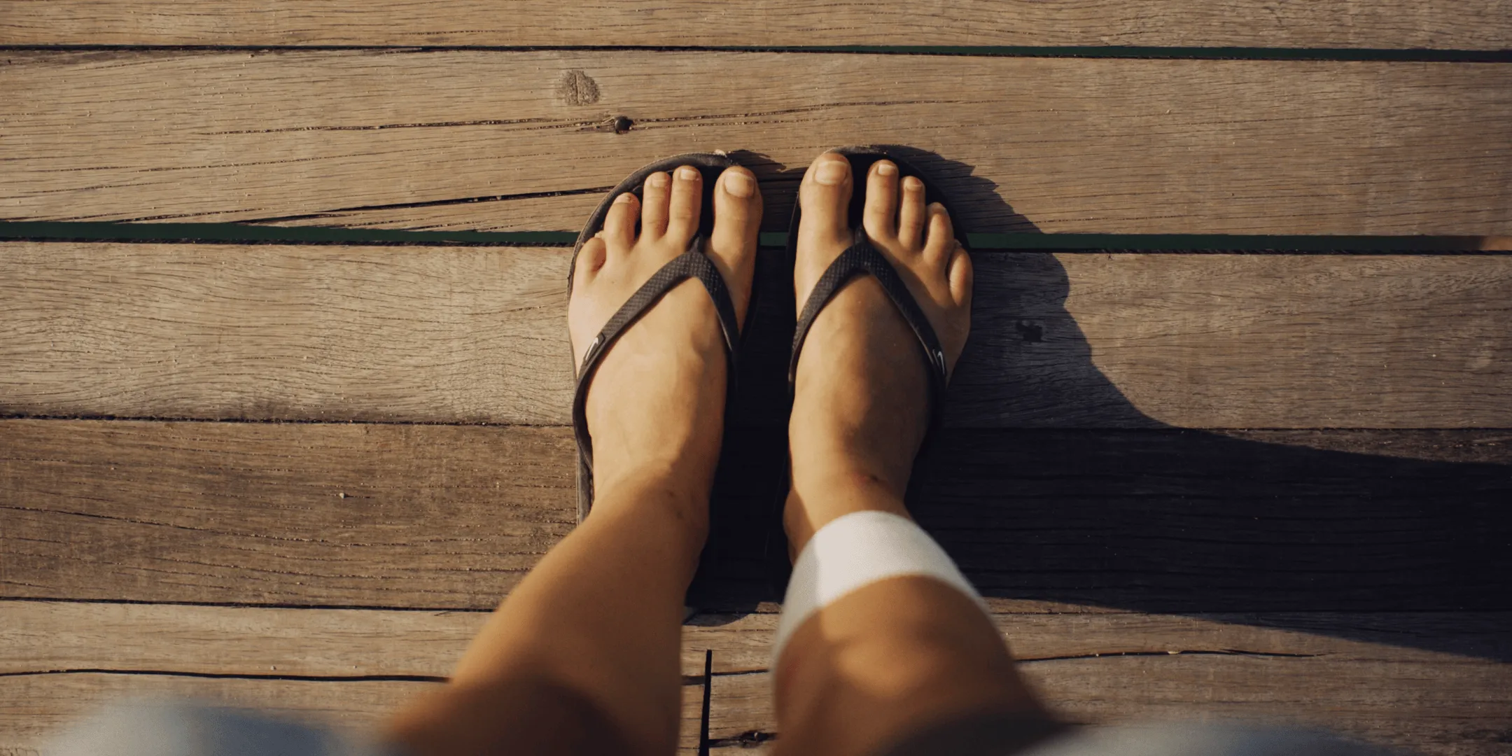 Flip flops commonly worn in summer but offering little foot protection