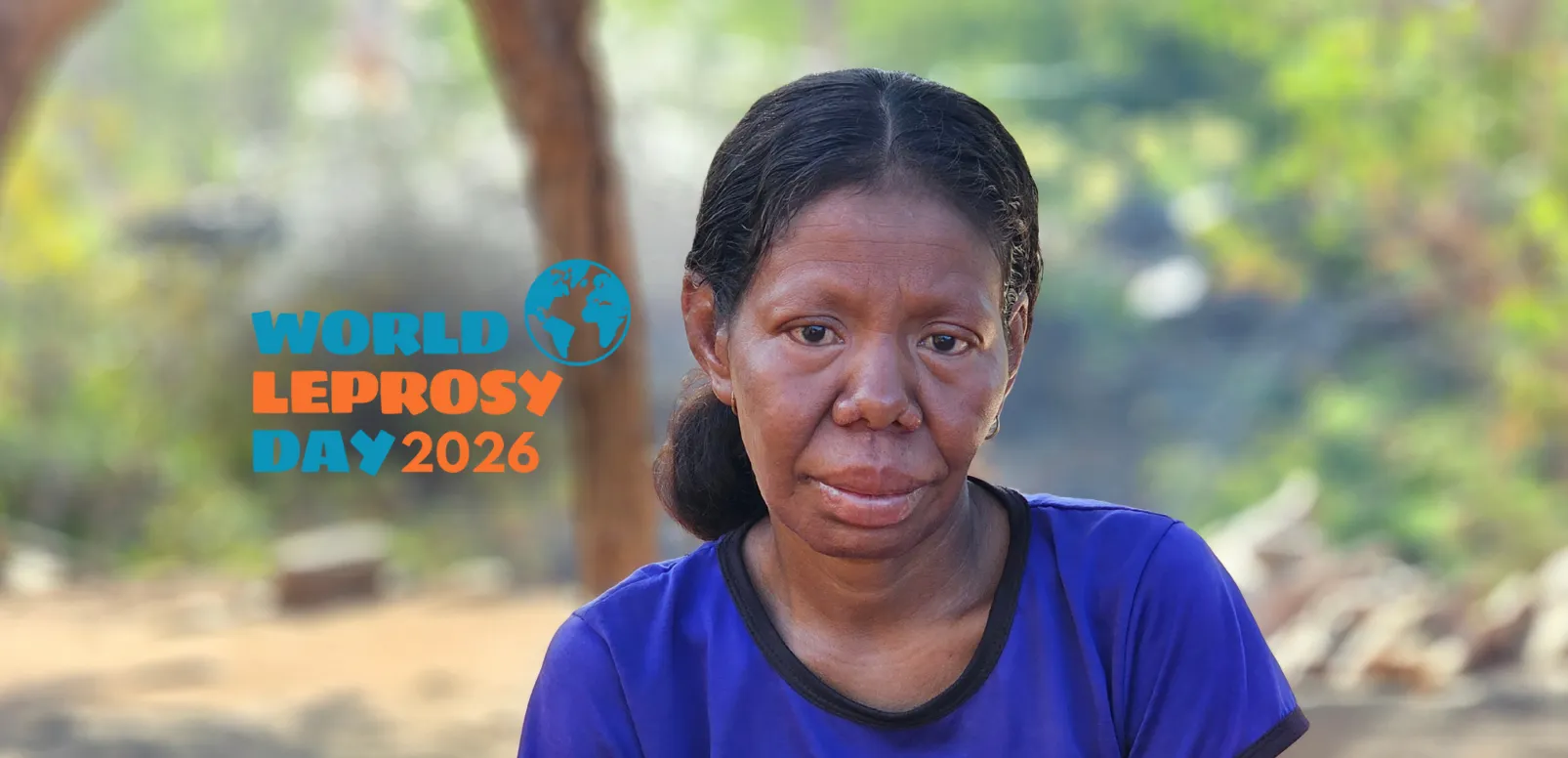 World Leprosy Day: A call for compassion, awareness and health for all