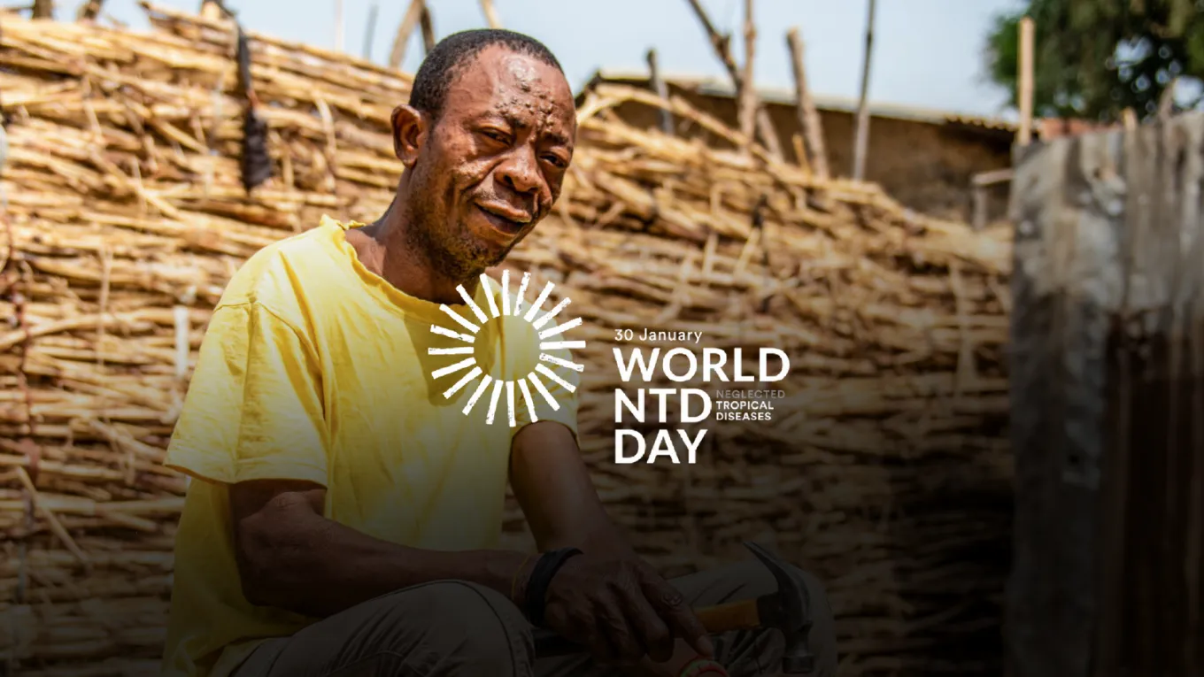 World NTD Day: What neglect really looks like for people affected by NTDs