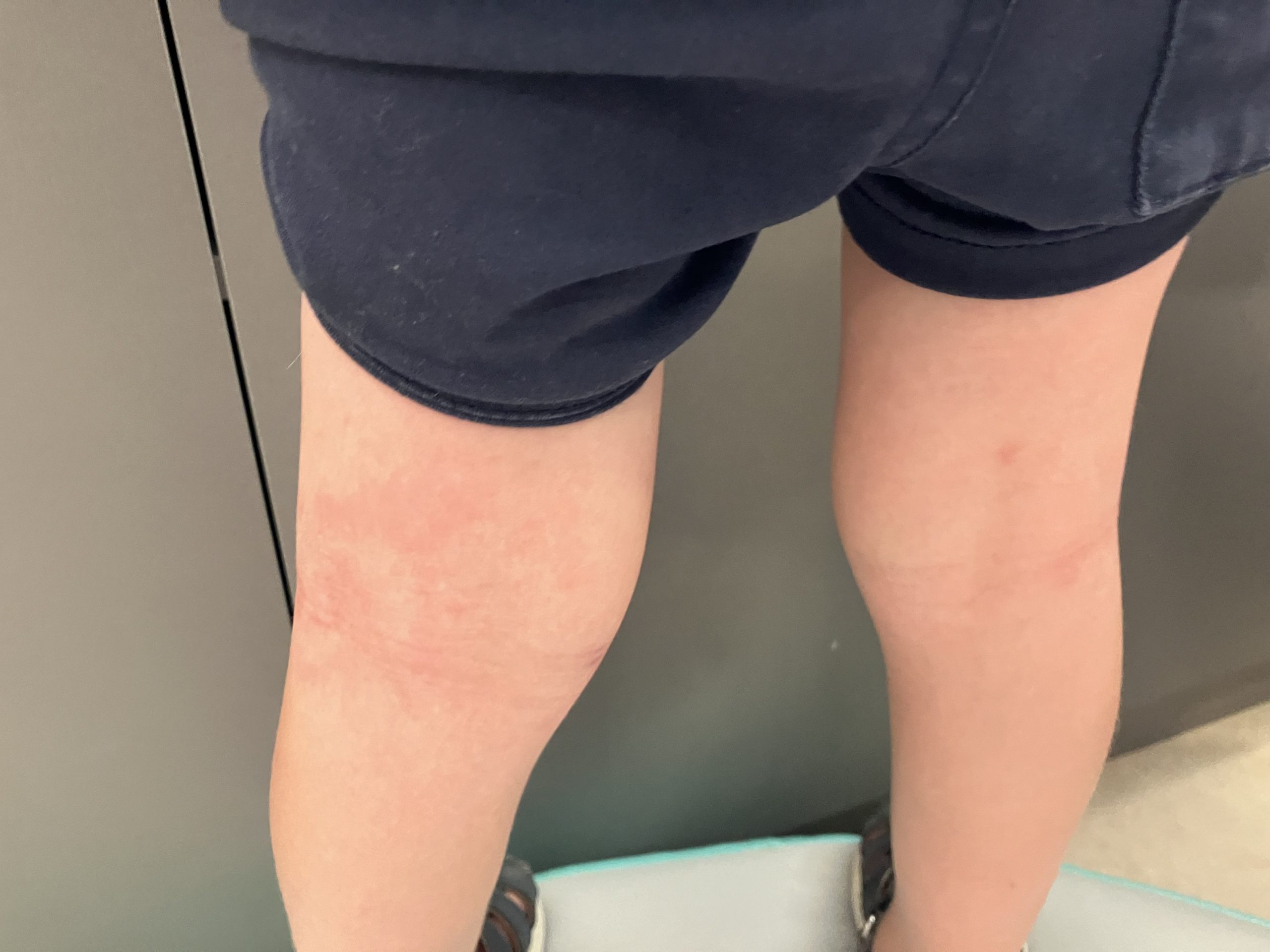 “Is this normal?” The question every mum knows