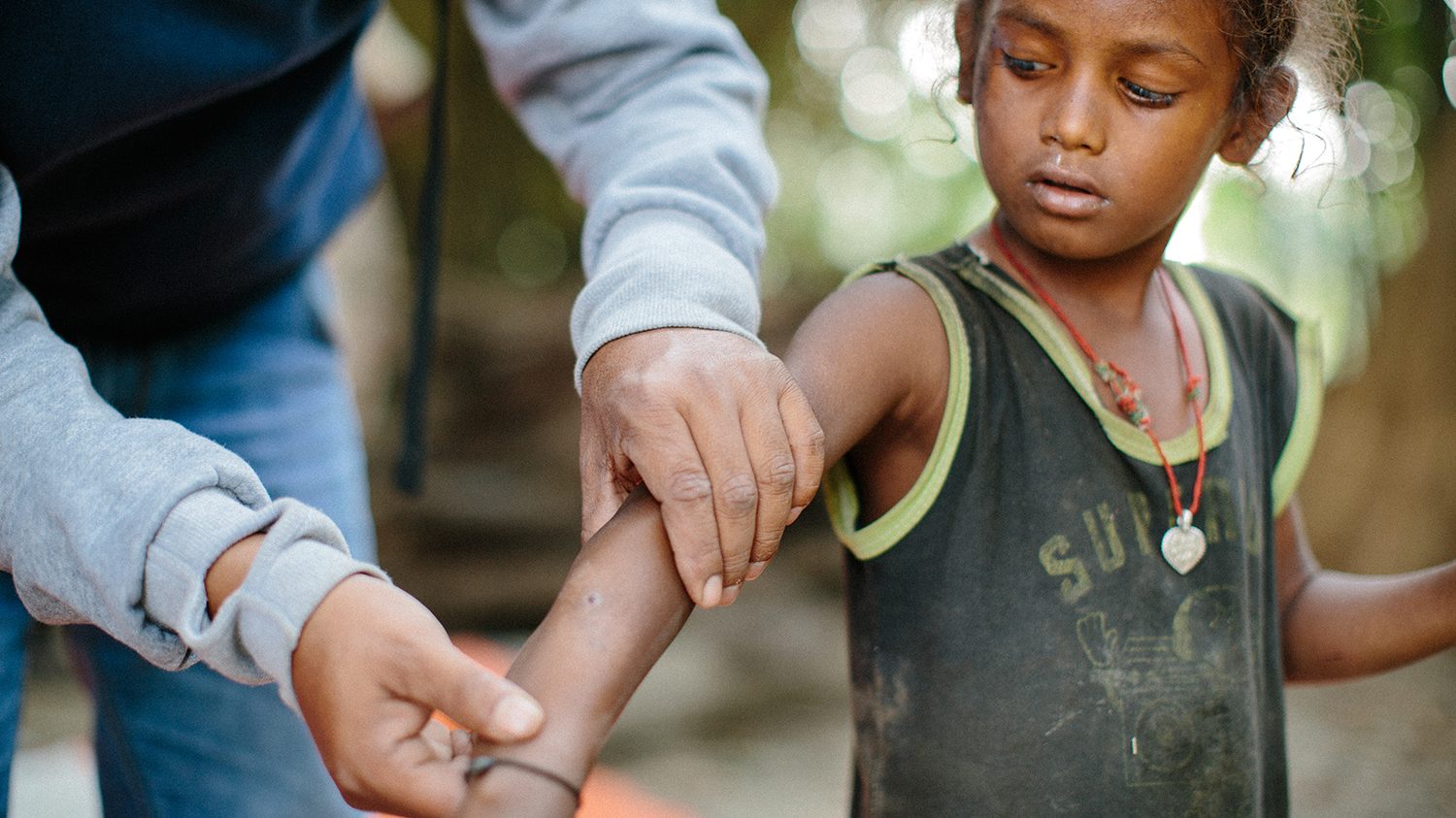 A community health worker provides care and support to a person affected by leprosy.